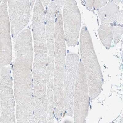 Immunohistochemistry-Paraffin: DNAM-1/CD226 Antibody [NBP1-85001]