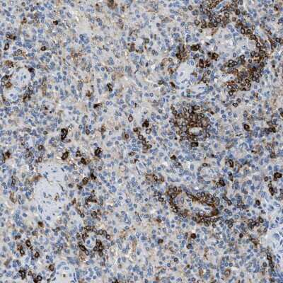 Immunohistochemistry-Paraffin: DNAM-1/CD226 Antibody [NBP1-85001]
