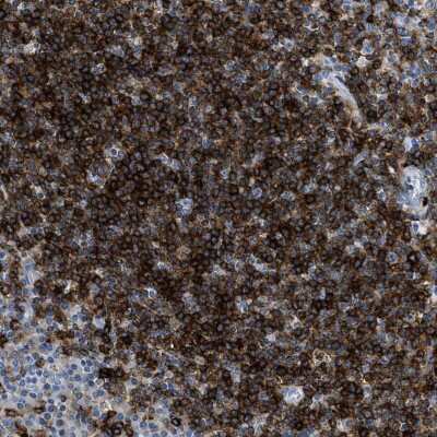 Immunohistochemistry-Paraffin: DNAM-1/CD226 Antibody [NBP1-85001]