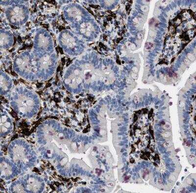 Immunohistochemistry-Paraffin: DNAM-1/CD226 Antibody [NBP1-85001]