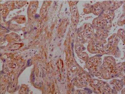 Immunohistochemistry-Paraffin: DNAM-1/CD226 Antibody (MM0248-1X20) - Azide and BSA Free [NBP2-12268]