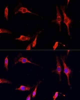 Immunocytochemistry/ Immunofluorescence: DNASE1 Antibody - Azide and BSA Free [NBP3-04947]