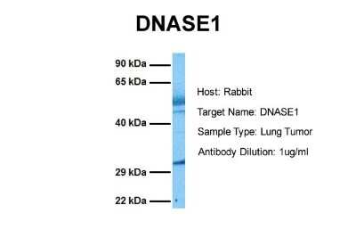 Western Blot: DNASE1 Antibody [NBP1-59404]