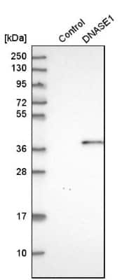 Western Blot: DNASE1 Antibody [NBP1-84999]