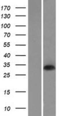 Western Blot: DNASE1L2 Overexpression Lysate [NBP2-08214]