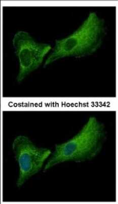 Immunocytochemistry/ Immunofluorescence: DNASE2B Antibody [NBP2-16199]