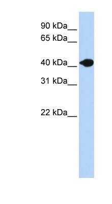 Western Blot: DNASE2B Antibody [NBP1-62278]