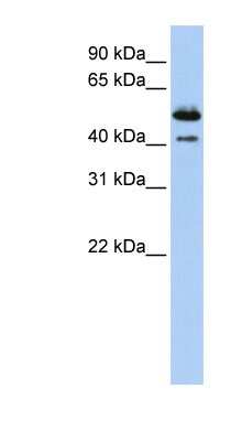 Western Blot: DNASE2B Antibody [NBP1-62279]