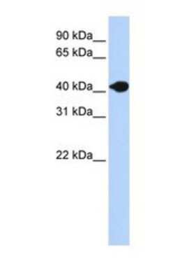 Western Blot: DNASE2B Antibody [NBP1-69308]