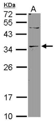 Western Blot: DNASE2B Antibody [NBP2-16199]