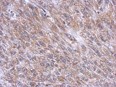 Immunohistochemistry-Paraffin: DNCIC1 Antibody [NBP2-16201]