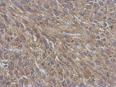 Immunohistochemistry-Paraffin: DNCIC1 Antibody [NBP2-16202]