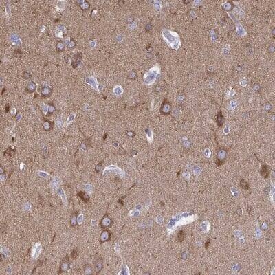Immunohistochemistry-Paraffin: DNCIC1 Antibody [NBP2-38933]