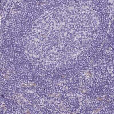 Immunohistochemistry-Paraffin: DNCIC1 Antibody [NBP2-38933]