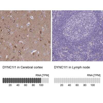 Immunohistochemistry-Paraffin: DNCIC1 Antibody [NBP2-38933]