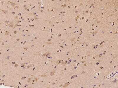 Immunohistochemistry-Paraffin: DNCIC1 Antibody [NBP2-97805]