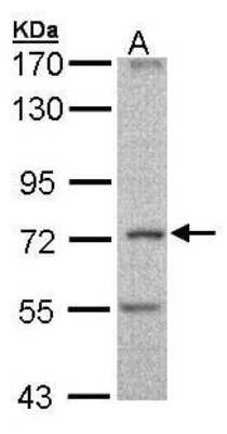 Western Blot: DNCIC1 Antibody [NBP1-32659]