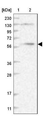 Western Blot: DYNC1LI1 Antibody [NBP1-87972]