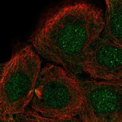 Immunocytochemistry/ Immunofluorescence: DNHD1 Antibody [NBP2-55492]