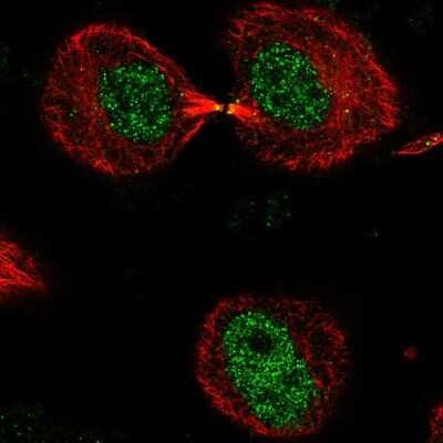 Immunocytochemistry/ Immunofluorescence: DNHD1 Antibody [NBP2-56959]