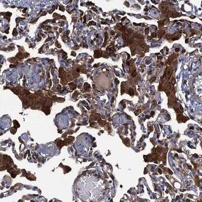 Immunohistochemistry-Paraffin: DNHD1 Antibody [NBP1-90741]