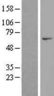 Western Blot: DNHD1 Overexpression Lysate [NBP2-05122]