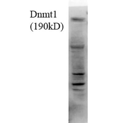 Western Blot: DNMT1 Antibody (4G11-C7) [NBP2-59344]