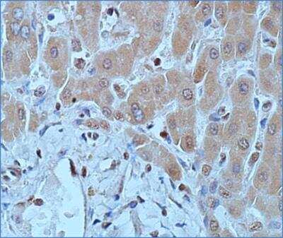 Immunohistochemistry-Paraffin: DNMT1 Antibody (60B1220.1) - BSA Free [NB100-56519]