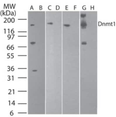 Western Blot: DNMT1 Antibody (60B1220.1)BSA Free [NB100-56519]