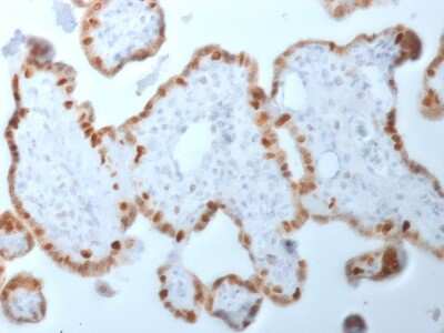 Immunohistochemistry-Paraffin: DNMT1 Antibody (DNMT1/2061) - Azide and BSA Free [NBP3-08482]