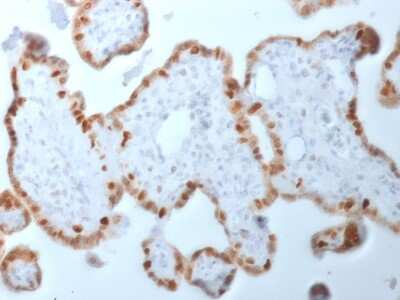 Immunohistochemistry-Paraffin: DNMT1 Antibody (DNMT1/2061) [NBP3-07671]