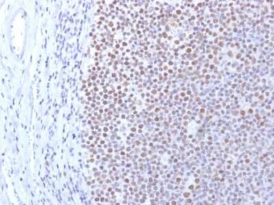 Immunohistochemistry-Paraffin: DNMT1 Antibody (DNMT1/2061) [NBP3-07671]