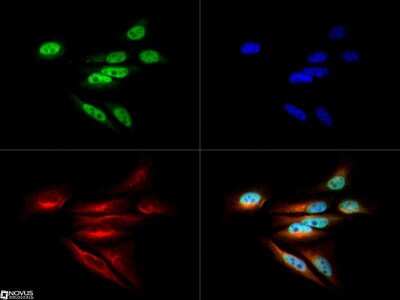 Immunocytochemistry/ Immunofluorescence: DNMT1 Antibody [NB100-264]