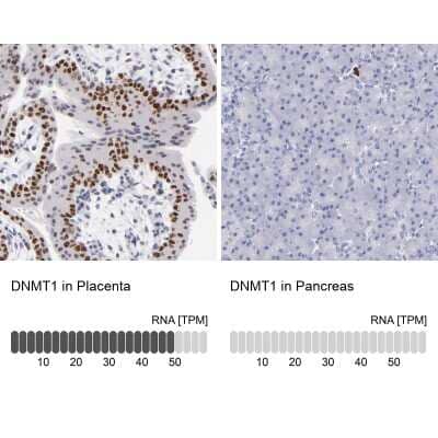 Immunohistochemistry-Paraffin: DNMT1 Antibody [NBP1-84328]