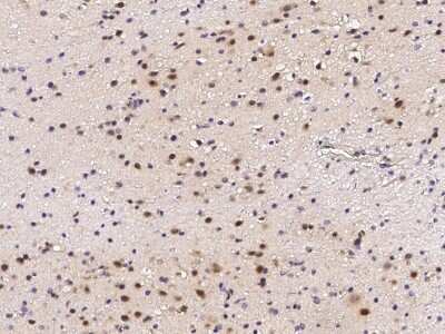 Immunohistochemistry-Paraffin: DNMT1 Antibody [NBP2-98763]