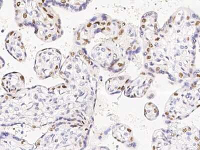 Immunohistochemistry-Paraffin: DNMT1 Antibody [NBP2-98763]