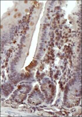 Immunohistochemistry-Paraffin: DNMT1 Antibody [NB100-264]