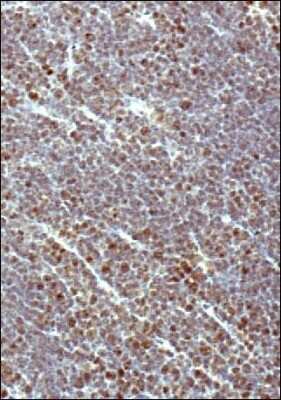 Immunohistochemistry-Paraffin: DNMT1 Antibody [NB100-264]