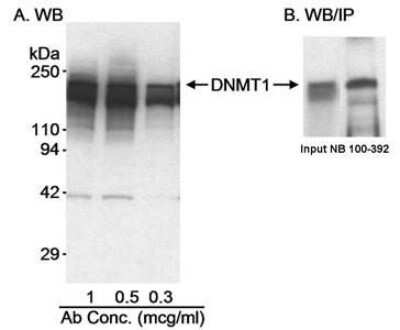 Immunoprecipitation: DNMT1 Antibody [NB100-392]