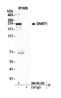 Immunoprecipitation: DNMT1 Antibody [NB100-392]