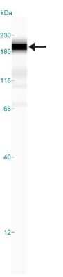 Simple Western: DNMT1 Antibody [NB100-264]
