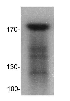 Western Blot: DNMT1 Antibody [NB100-392]