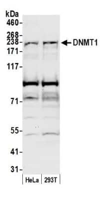 Western Blot: DNMT1 Antibody [NB100-392]