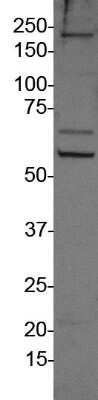 Western Blot: 0 [NB100-264]