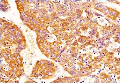 Immunohistochemistry-Paraffin: DNMT3A Antibody (64B1446) - BSA Free [NB120-13888]