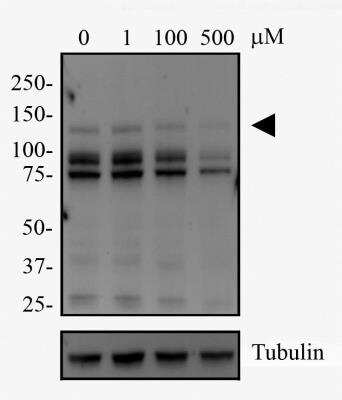 Western Blot: DNMT3A Antibody (64B1446)BSA Free [NB120-13888]