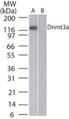 Western Blot: DNMT3A Antibody (64B814.1) [NB100-56521]