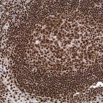 Immunohistochemistry-Paraffin: DNMT3A Antibody [NBP1-85961]