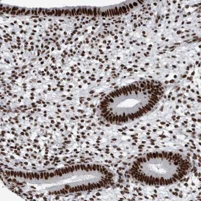 Immunohistochemistry-Paraffin: DNMT3A Antibody [NBP1-85961]