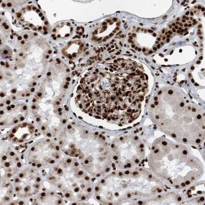 Immunohistochemistry-Paraffin: DNMT3A Antibody [NBP1-85961]